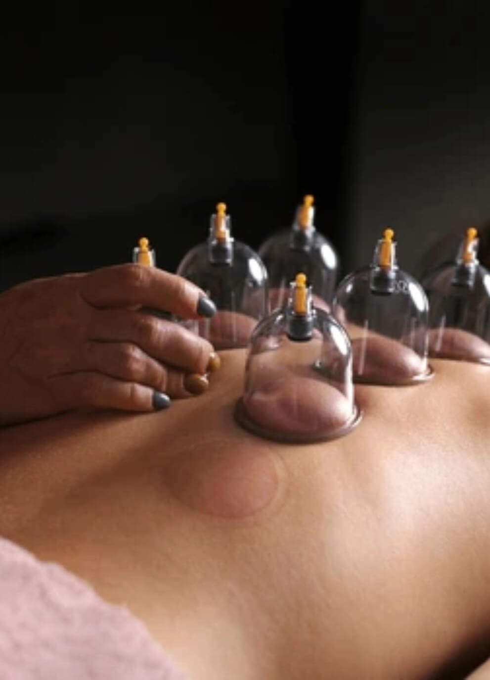 https://omer.zynk.ae/wp-content/uploads/2025/04/Cupping-massage.jpg